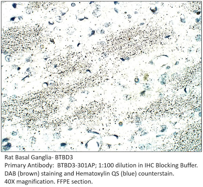 BTBD3 Antibody in Immunohistochemistry (IHC)