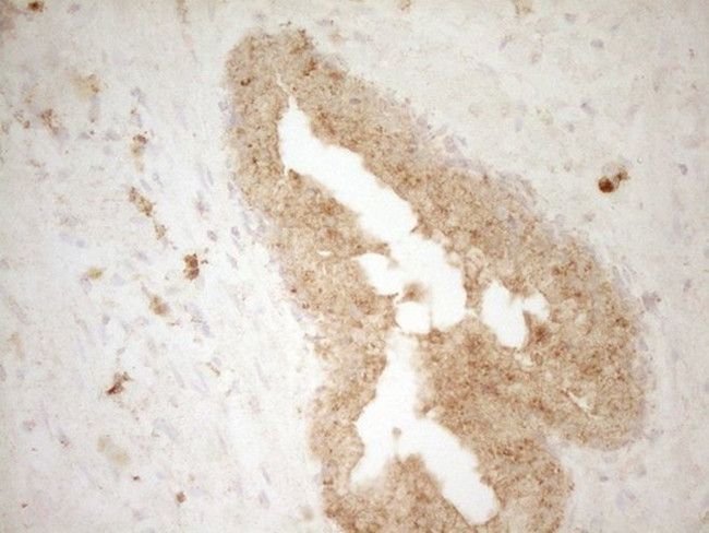 BTG1 Antibody in Immunohistochemistry (Paraffin) (IHC (P))