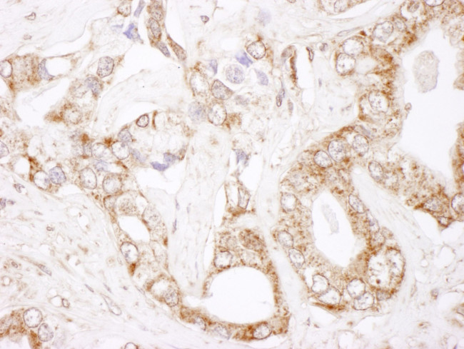 Bcl-2 Antibody in Immunohistochemistry (IHC)