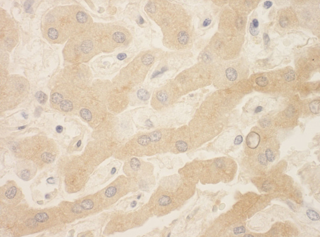 Beta-2-Glycoprotein 1 Antibody in Immunohistochemistry (IHC)