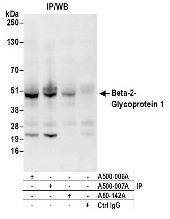 Beta-2-Glycoprotein 1 Antibody in Western Blot (WB)