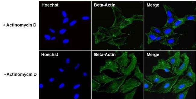 beta Actin Antibody