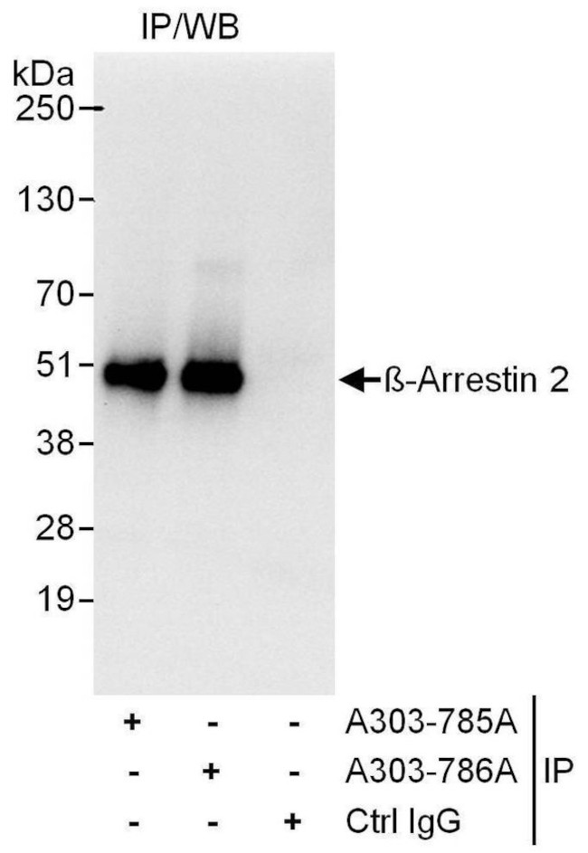 Beta-Arrestin 2 Antibody in Immunoprecipitation (IP)