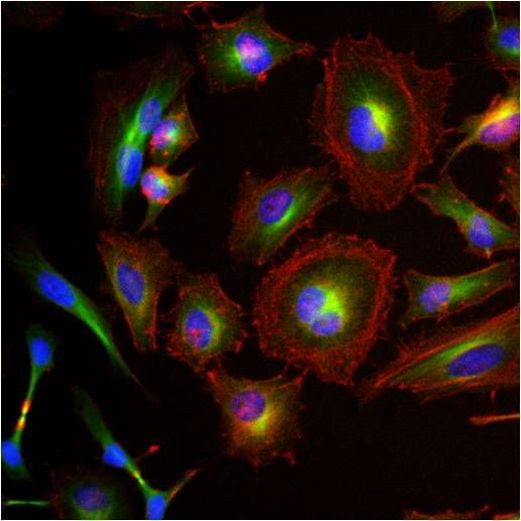 beta Tubulin Loading Control Antibody in Immunocytochemistry (ICC/IF)