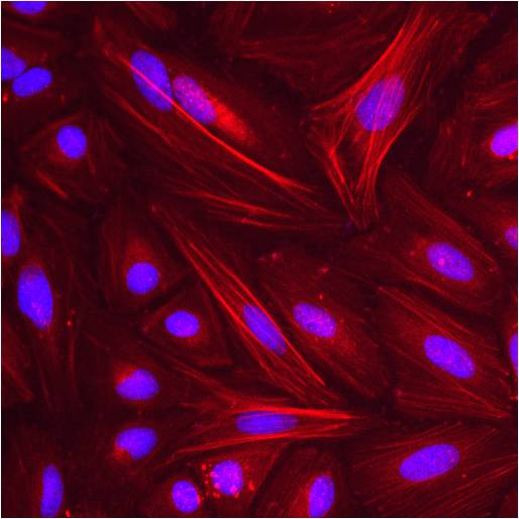 beta Actin Antibody in Immunocytochemistry (ICC/IF)