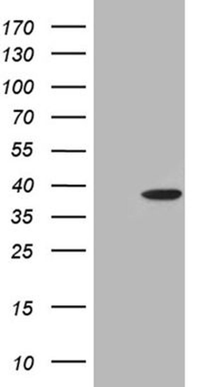 C1orf111 Antibody in Western Blot (WB)