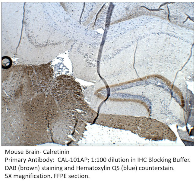 Calretinin Antibody in Immunohistochemistry (IHC)