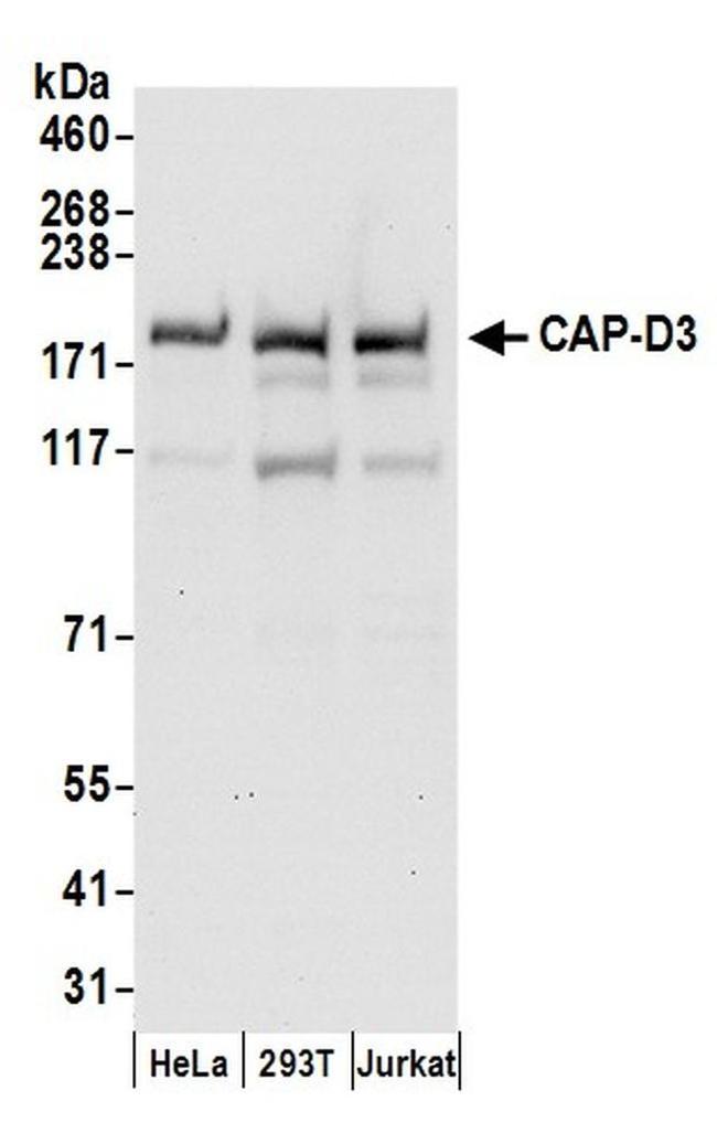 CAP-D3 Antibody in Western Blot (WB)