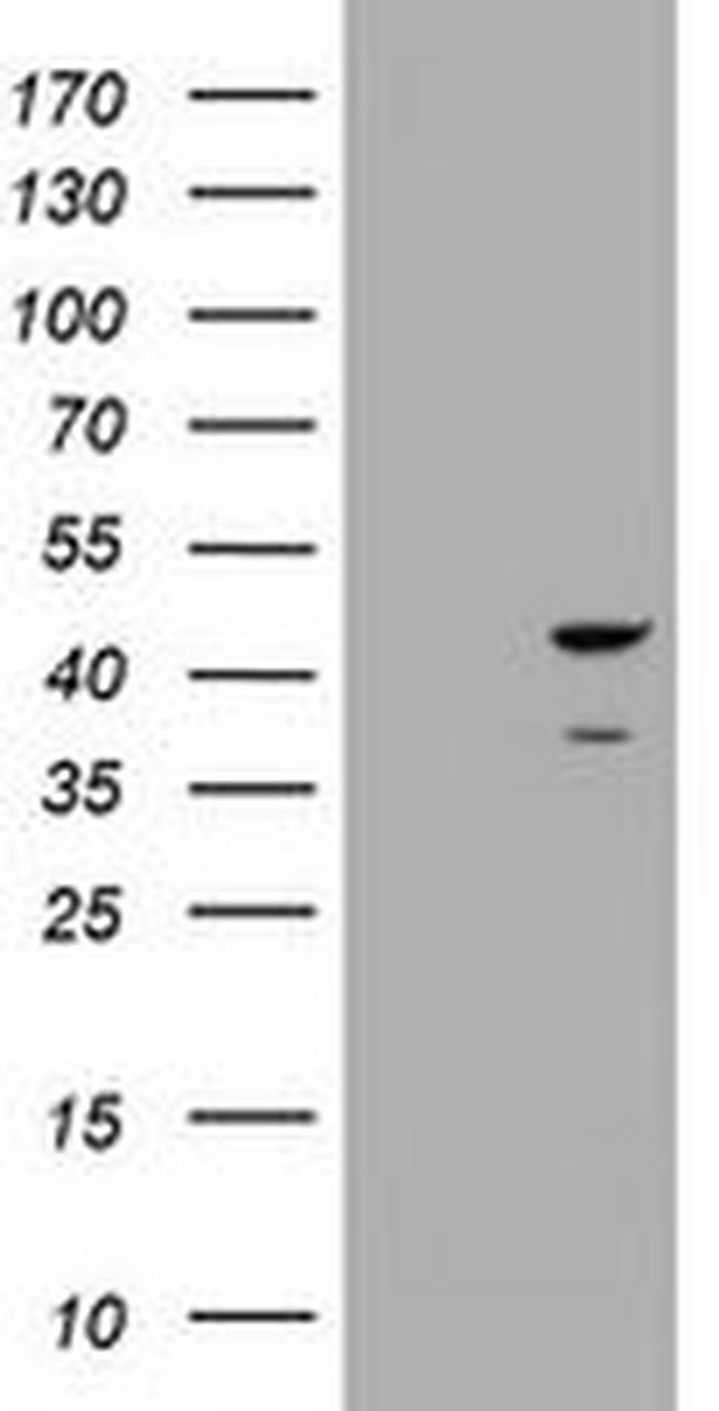 CBX8 Antibody in Western Blot (WB)