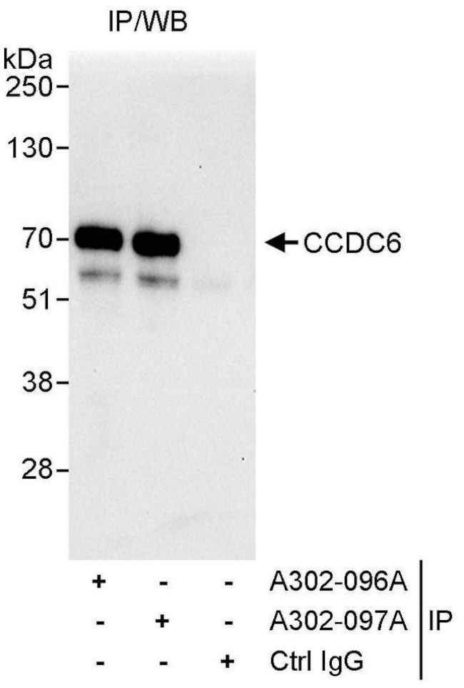 CCDC6 Antibody in Immunoprecipitation (IP)