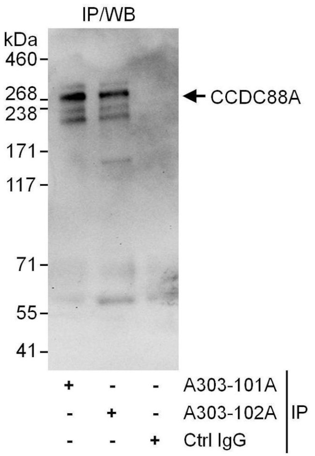 CCDC88A Antibody in Immunoprecipitation (IP)