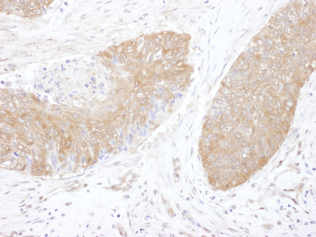 CCT5 Antibody in Immunohistochemistry (IHC)