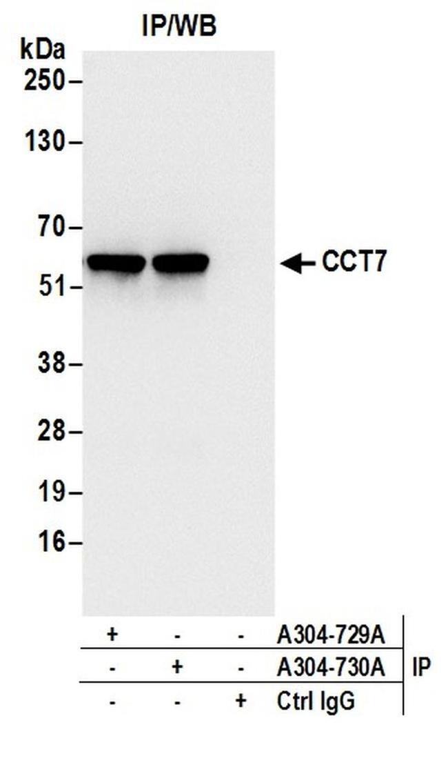 CCT7 Antibody in Western Blot (WB)
