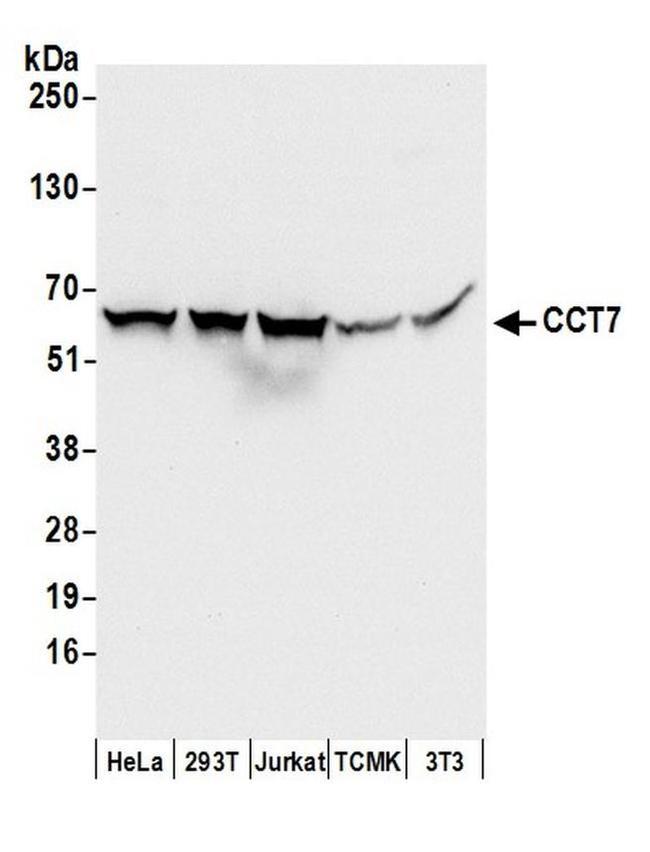 CCT7 Antibody in Western Blot (WB)