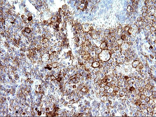 CD33 Antibody in Immunohistochemistry (Paraffin) (IHC (P))