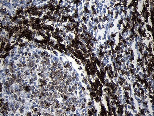 CD79B Antibody in Immunohistochemistry (Paraffin) (IHC (P))