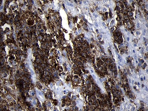 CD79B Antibody in Immunohistochemistry (Paraffin) (IHC (P))