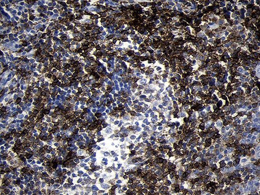 CD79B Antibody in Immunohistochemistry (Paraffin) (IHC (P))