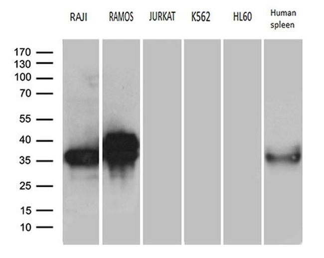 CD79B Antibody in Western Blot (WB)