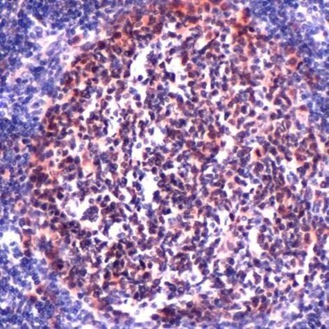 CDK2 Antibody in Immunohistochemistry (IHC)