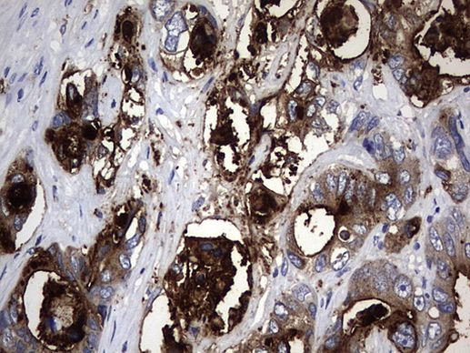 CEA (CEACAM5) Antibody in Immunohistochemistry (Paraffin) (IHC (P))