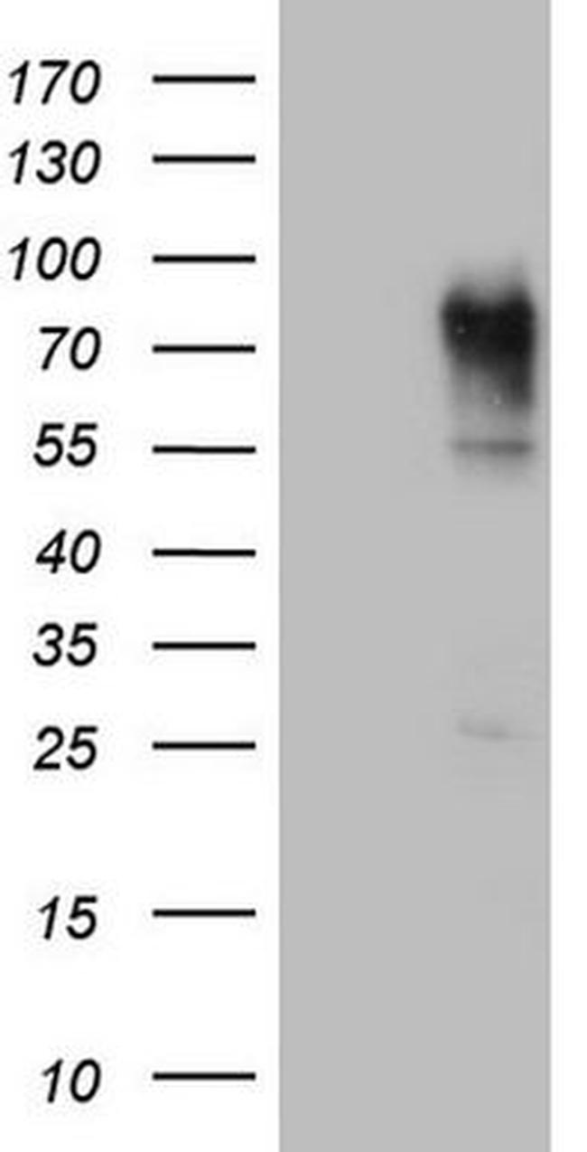 CEA (CEACAM5) Antibody in Western Blot (WB)