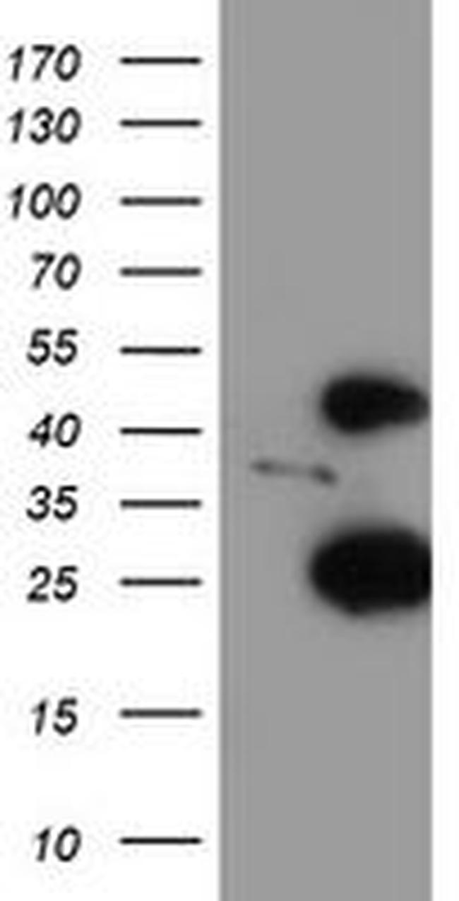 CENPH Antibody in Western Blot (WB)