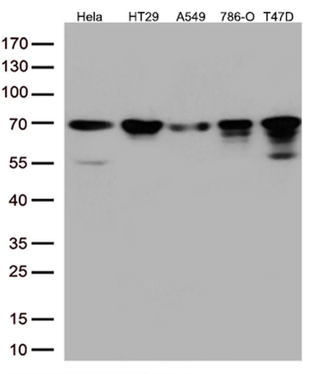 MSF (SEPT9) Antibody in Western Blot (WB)