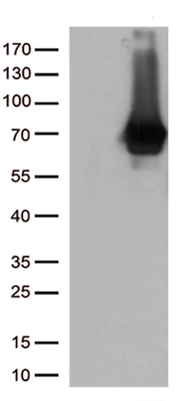 MSF (SEPT9) Antibody in Western Blot (WB)