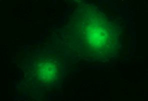 CHAC1 Antibody in Immunocytochemistry (ICC/IF)