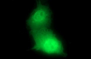 CHAC1 Antibody in Immunocytochemistry (ICC/IF)