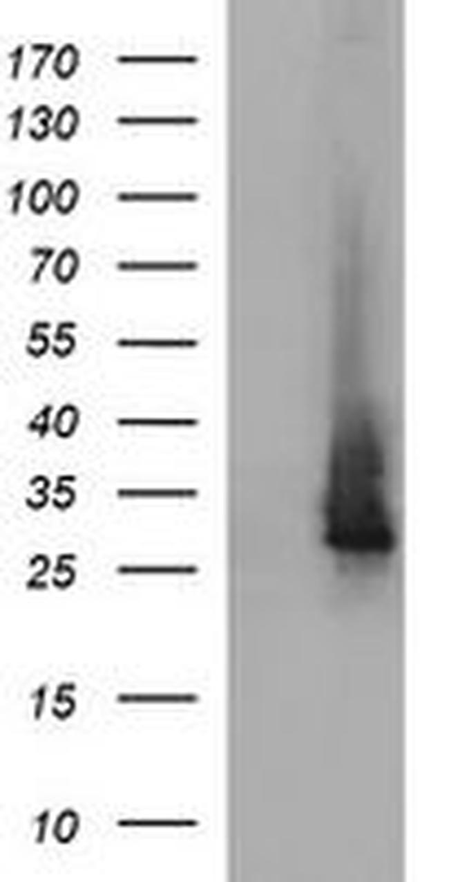 CHAC1 Antibody in Western Blot (WB)