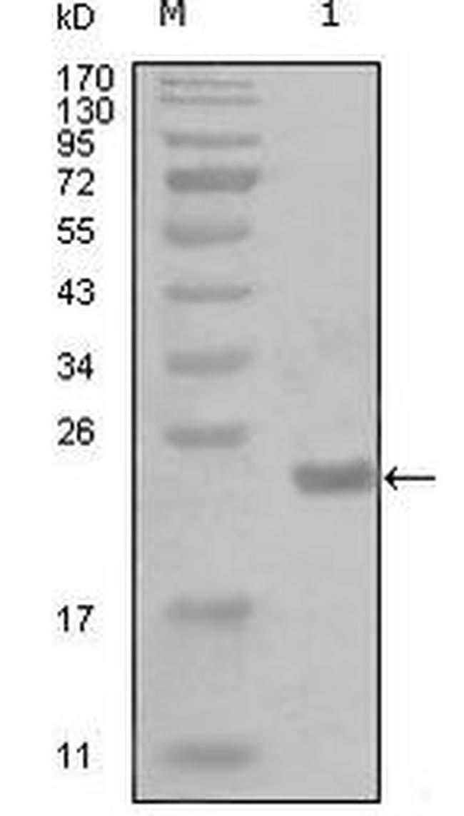 IKK alpha Antibody in Western Blot (WB)