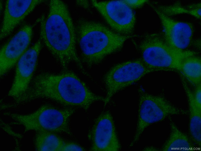 VCP Antibody in Immunocytochemistry (ICC/IF)