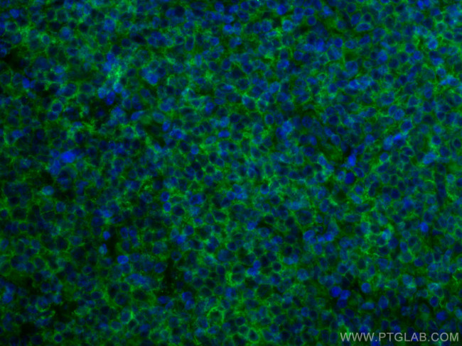 HLA class I ABC Antibody in Immunohistochemistry (PFA fixed) (IHC (PFA))