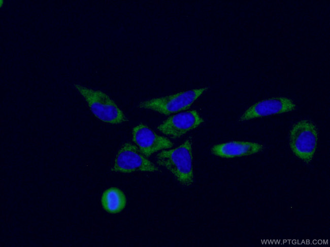 RPL3 Antibody in Immunocytochemistry (ICC/IF)