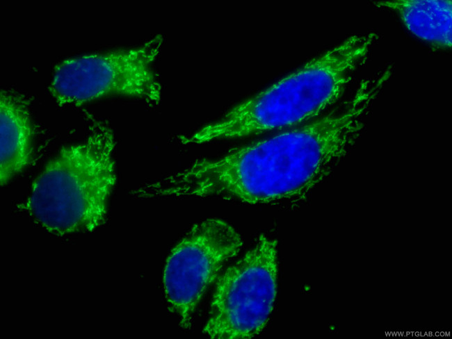 ATP5O Antibody in Immunocytochemistry (ICC/IF)