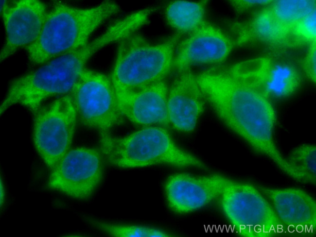 ASK1 Antibody in Immunocytochemistry (ICC/IF)