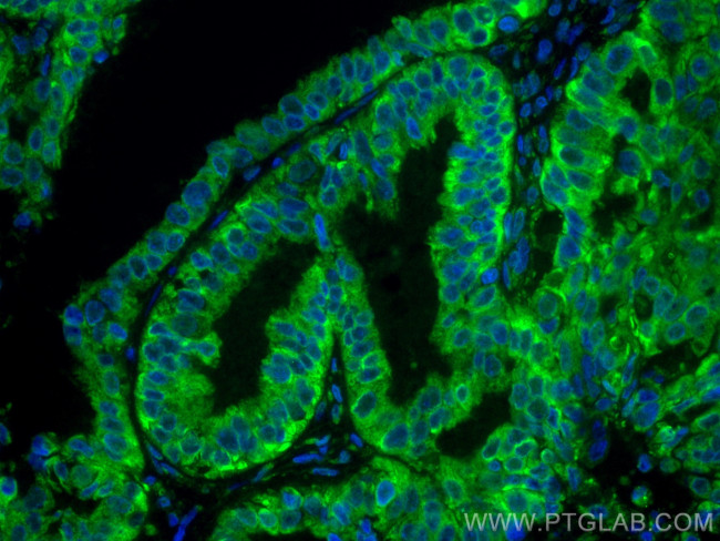 TRAPA/SSR1 Antibody in Immunohistochemistry (PFA fixed) (IHC (PFA))