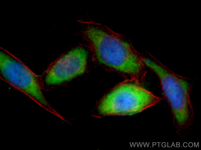 S100A11 Antibody in Immunocytochemistry (ICC/IF)