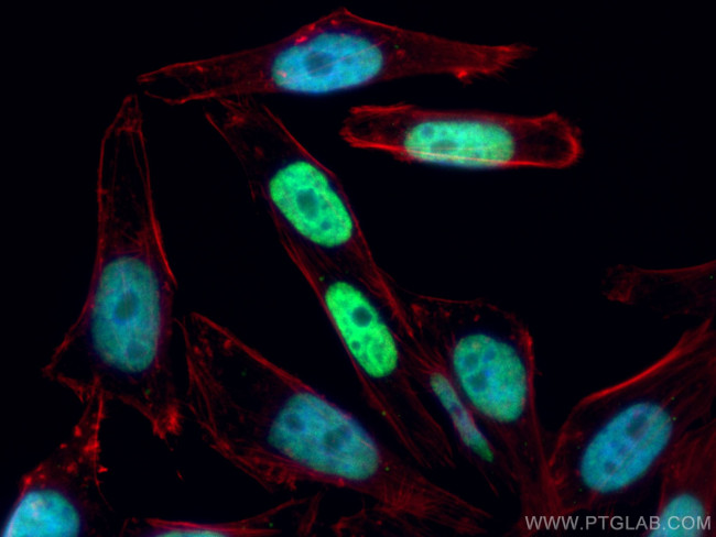 MECP2 Antibody in Immunocytochemistry (ICC/IF)