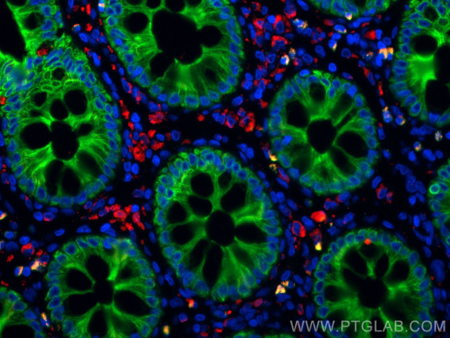 Cytokeratin 20 Antibody in Immunohistochemistry (Paraffin) (IHC (P))