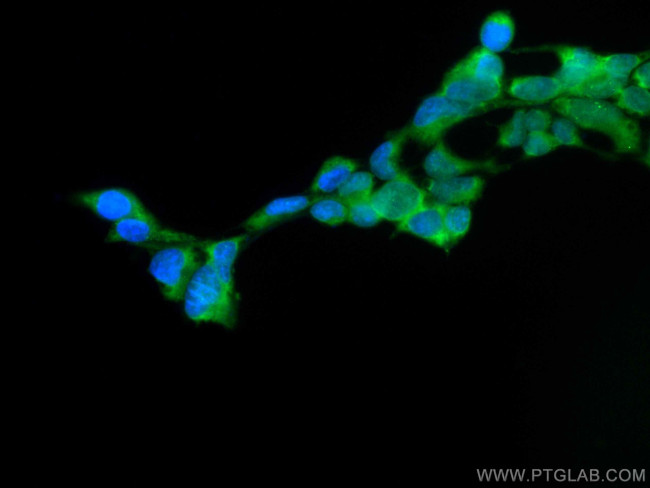 GPX4 Antibody in Immunocytochemistry (ICC/IF)