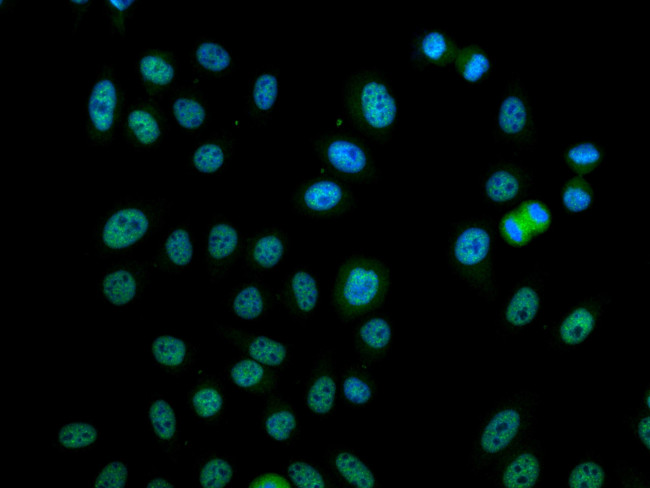 Phospho-mTOR (Ser2448) Antibody in Immunocytochemistry (ICC/IF)