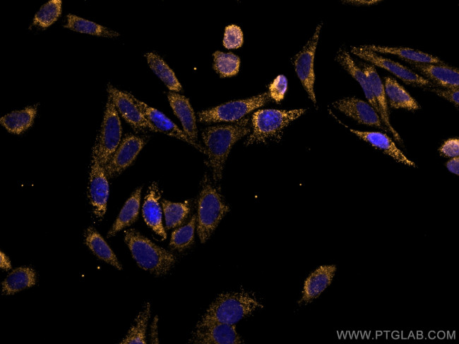 STAT4 Antibody in Immunocytochemistry (ICC/IF)