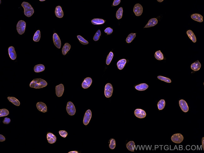 Lamin B1 Antibody in Immunocytochemistry (ICC/IF)