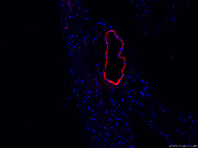 transgelin/SM22 Antibody in Immunohistochemistry (PFA fixed) (IHC (PFA))