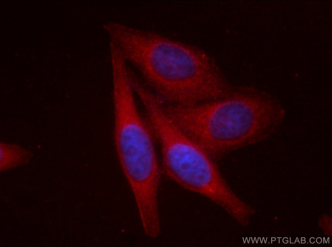 GOT1 Antibody in Immunocytochemistry (ICC/IF)