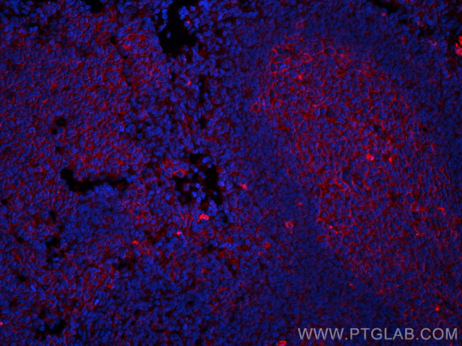 CD147 Antibody in Immunohistochemistry (PFA fixed) (IHC (PFA))