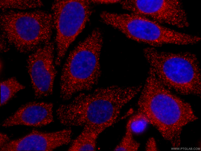 CLTC Antibody in Immunocytochemistry (ICC/IF)